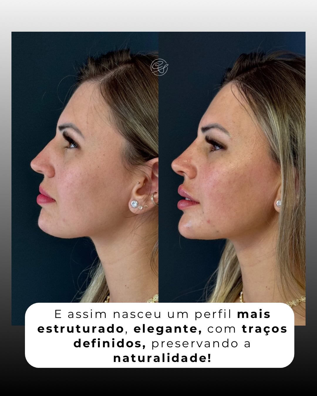 SaveClip.App_656670364_18567086761001626_7372584158834973518_n