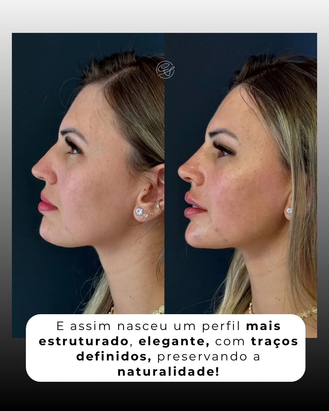 SaveClip.App_656670364_18567086761001626_7372584158834973518_n