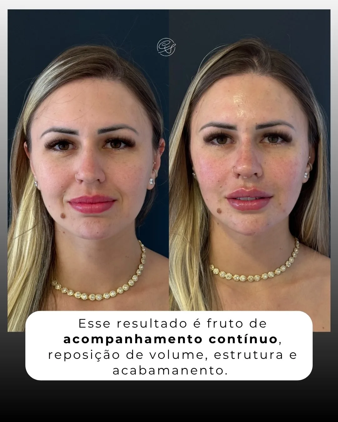 SaveClip.App_657331902_18567086770001626_6684602716653786411_n