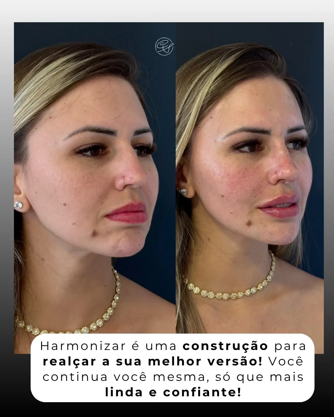 SaveClip.App_657726150_18567086737001626_9166992846399610315_n